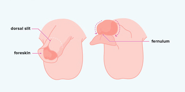 Circumcision in jaipur
