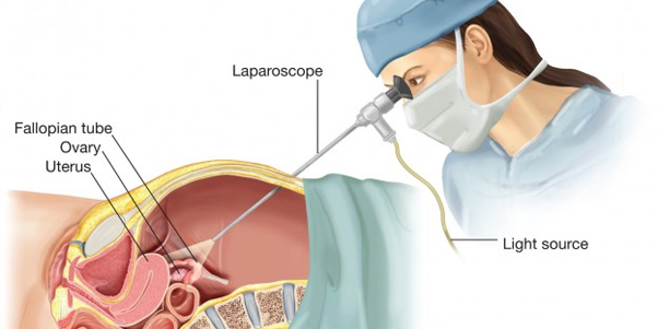 Laparoscopy – Minimally Invasive in Jaipur