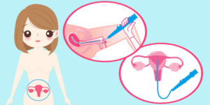 Hysteroscopy Procedure specialist in jaipur