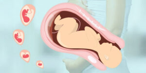 Normal Delivery Process Explained by Dr. Raman Narang – Expert Gynecologist in Jaipur